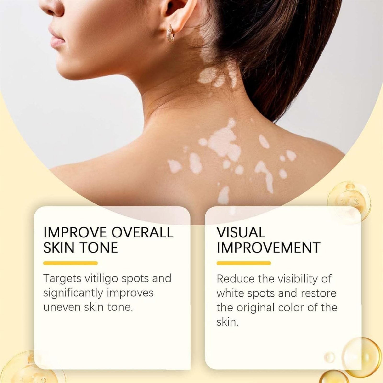 Vitigo Bee Venom Treatment Cream | Natural Skin Repair Hydration Relief Anti-Irritation - Image 3