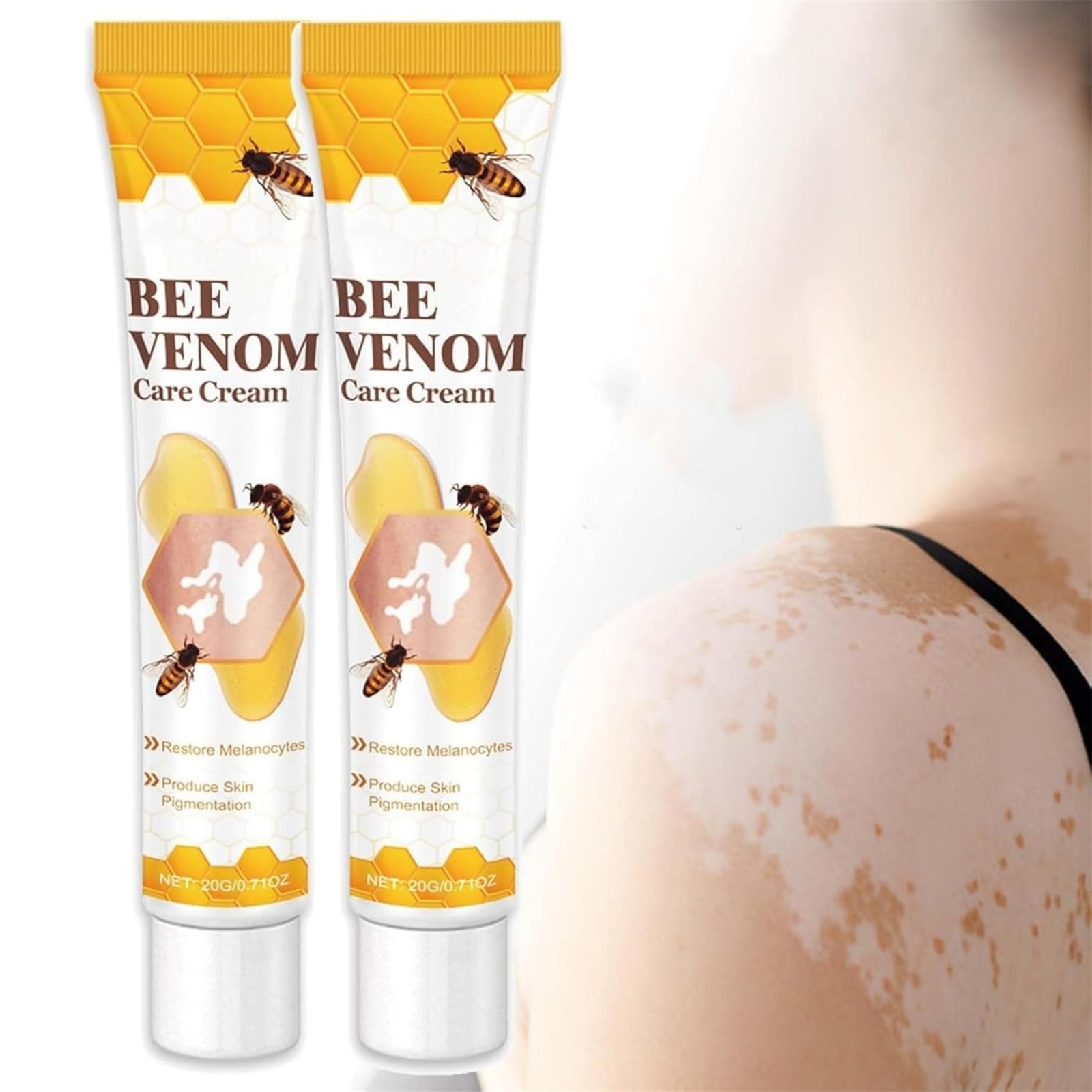 Vitigo Bee Venom Treatment Cream | Natural Skin Repair Hydration Relief Anti-Irritation - Image 5