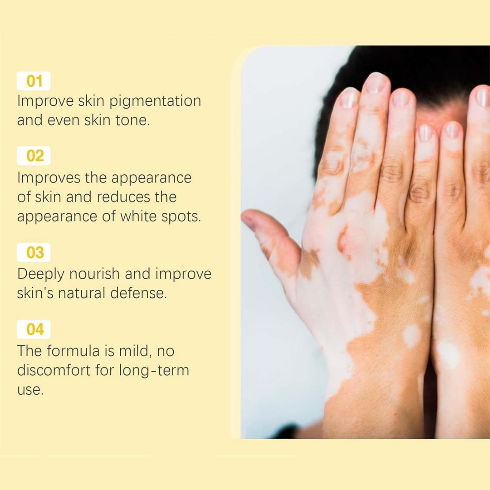 Vitigo Bee Venom Treatment Cream | Natural Skin Repair Hydration Relief Anti-Irritation - Image 7